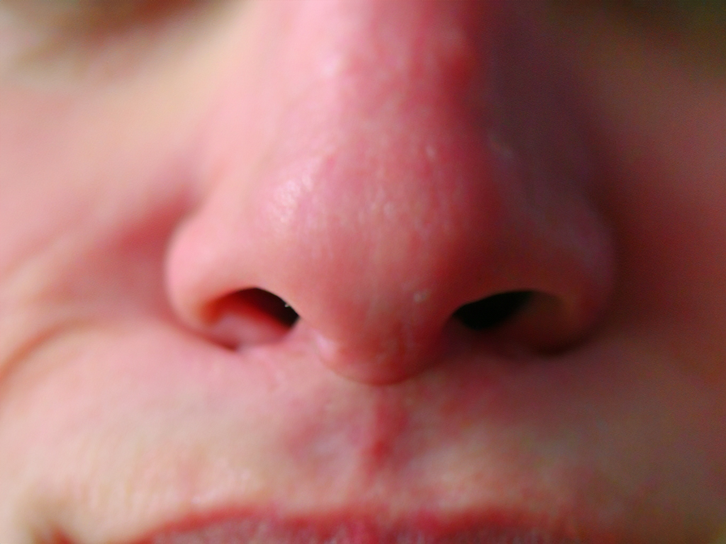 Navage Nose Cleaner KAUFEN aus Hot oder Schrott